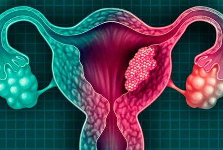 El programa de cribado de cáncer de cuello de útero en Castilla-La Mancha llegará a toda la población diana de mujeres entre 25 y 65 años