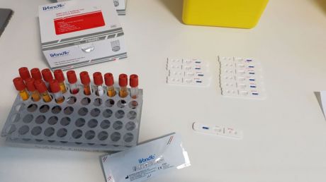 Castilla-La Mancha confirma 824 nuevos casos por infección de coronavirus