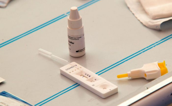 La venta de test de antígenos para detectar covid-19 sube un 372% respecto a junio