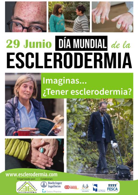 Cuenca visibiliza la Esclerodermia