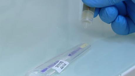 El Programa de Cribado de Cáncer de Colon y Recto ha permitido detectar un total de 423 tumores malignos en fases precoces
