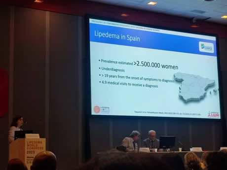 La doctora Elena Vaquero Ramiro, jefa de Sección del Servicio de Medicina Física y Rehabilitación del HUCU, durante su ponencia en el Congreso Mundial de Lipedema 2025 en Roma.