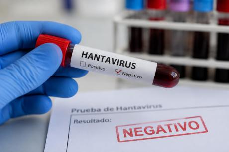 Las pruebas microbiológicas dan negativo al contacto de hantavirus localizado en la provincia de Cuenca
