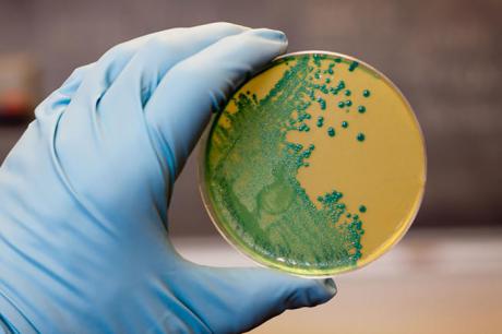 La listeria: Una bacteria peligrosa y resistente, aunque muy controlada