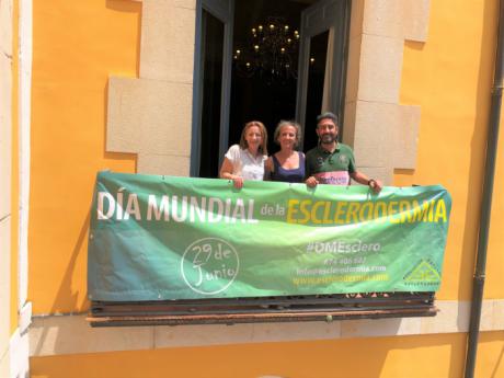 El Ayuntamiento se une a la conmemoración del Día Mundial de la Esclerodermia